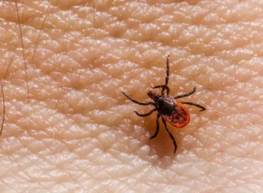 Another Karachi resident has died from Congo virus