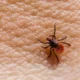 Another Karachi resident has died from Congo virus