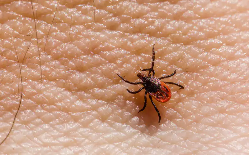 Another Karachi resident has died from Congo virus