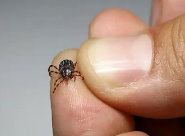 Citizen Died from the Congo Virus in Karachi