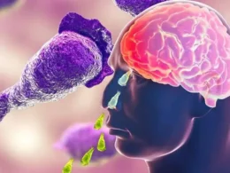 One Person has Died from Naegleria in Karachi