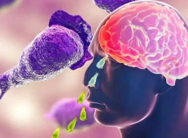 One Person has Died from Naegleria in Karachi