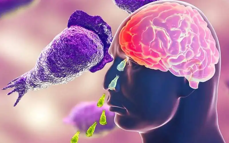 One Person has Died from Naegleria in Karachi