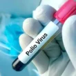 Polio Virus Confirmed in 47 Environmental Samples in Pakistan