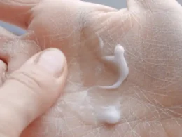 Why does skin remain dry despite moisturizing?