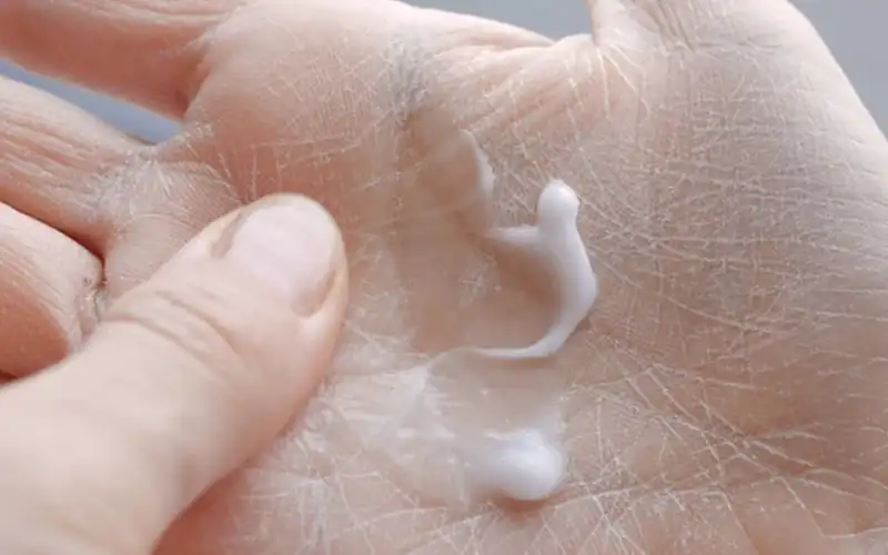 Why does skin remain dry despite moisturizing?