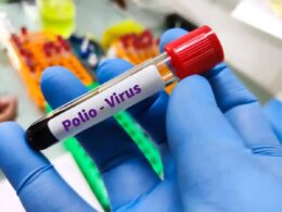 What was the number of polio cases across the country in 2025?