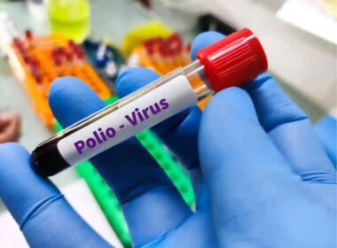 What was the number of polio cases across the country in 2025?