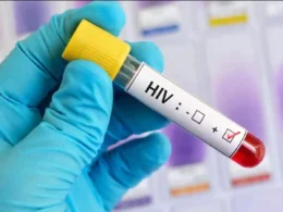 Rise in HIV cases in Sindh