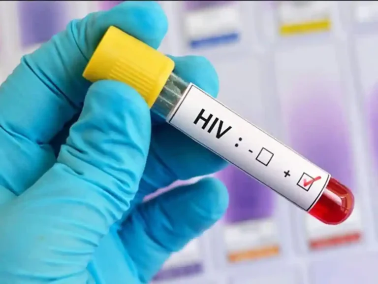 Rise in HIV cases in Sindh