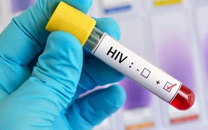 Rise in HIV cases in Sindh